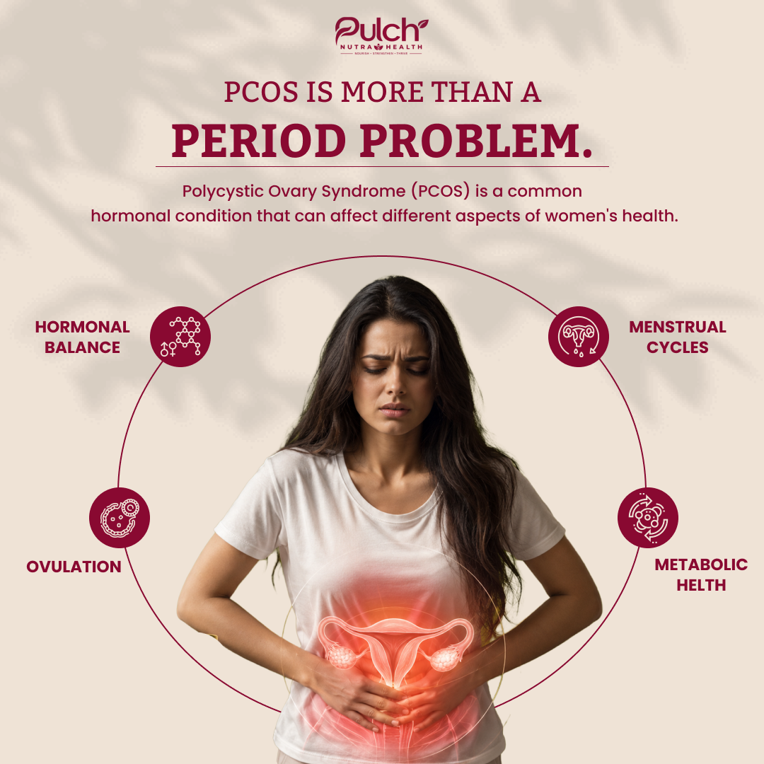 Woman pcos capsule
